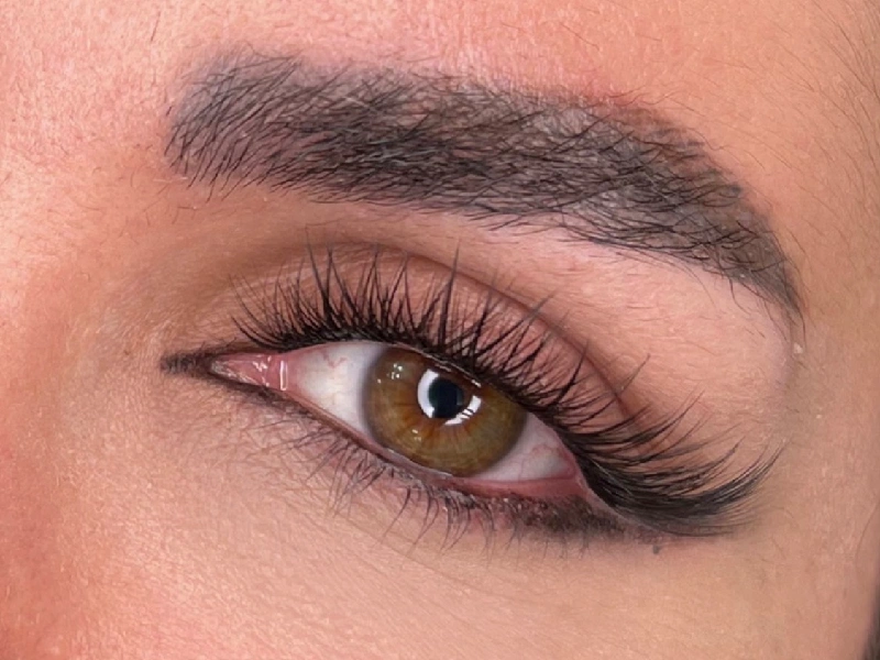 Best Eyelash Transplantation Centers in Mashhad 1 1