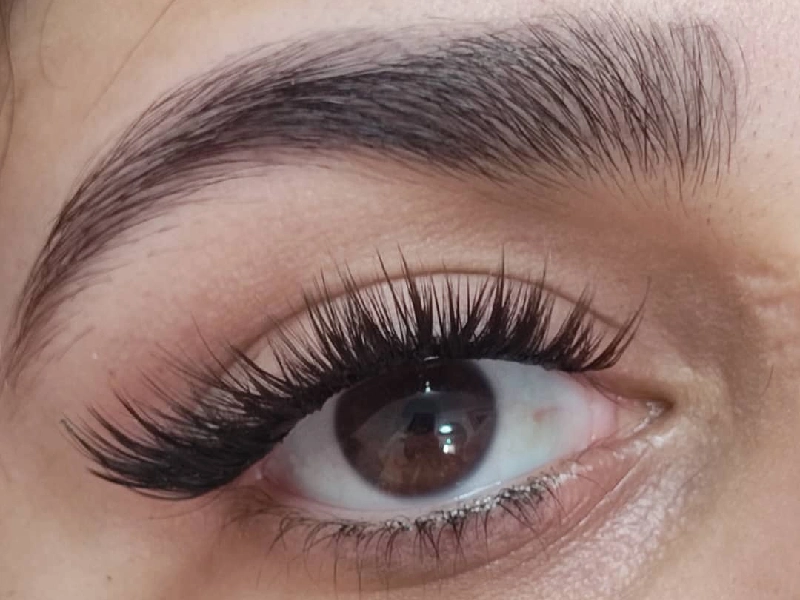 Best Eyelash Transplantation Centers in Mashhad 1 2