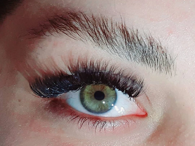 Best Eyelash Transplantation Centers in Mashhad 2 2