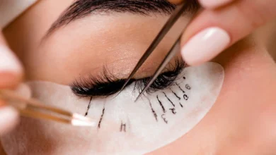 Best Eyelash Transplantation Centers in Mashhad 3 2