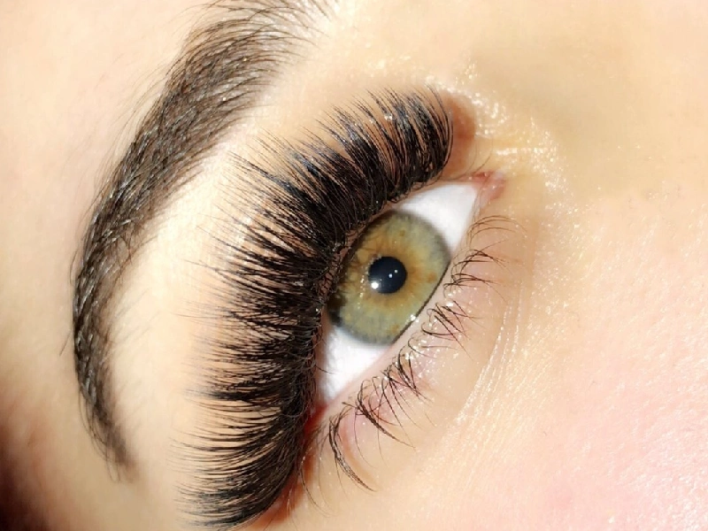 Best Eyelash Transplantation Centers in Mashhad 4 2
