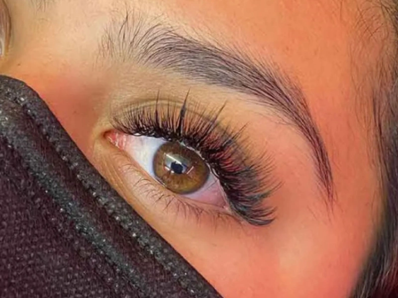 Best Eyelash Transplantation Centers in Mashhad 5 2