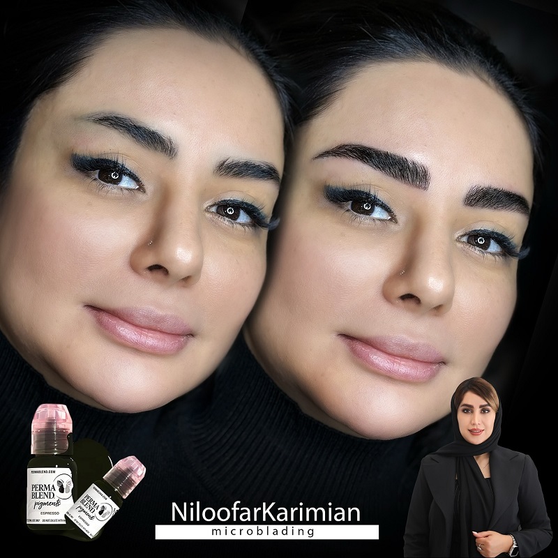میکروبلیدینگ نیلوفر کریمیان
