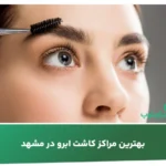 بهترین مراکز کاشت ابرو در مشهد