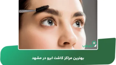 بهترین مراکز کاشت ابرو در مشهد