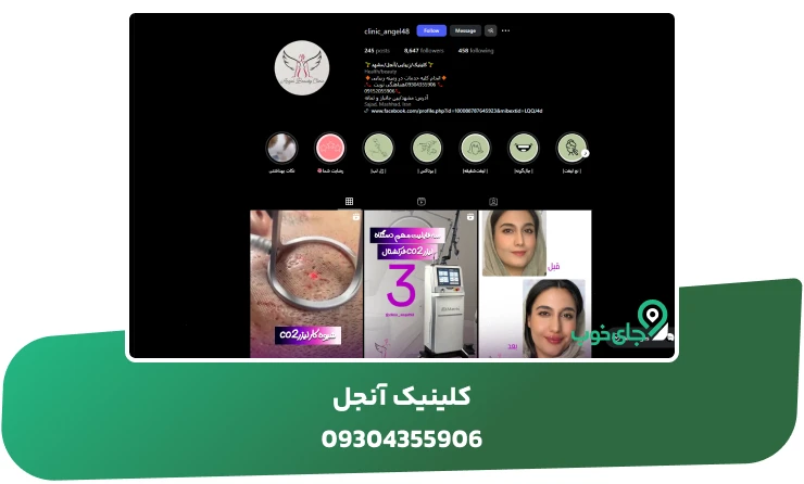 کلینیک آنجل