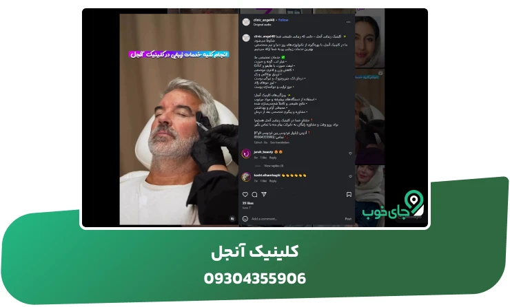 خدمات زیبایی آقایان در کلینیک آنجل مشهد