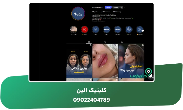 کلینیک الین