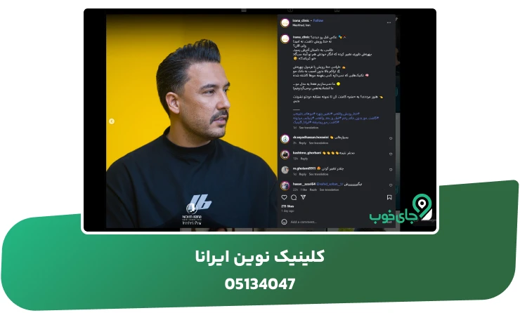 کاشت مو آقایان در کلینیک ایرانا مشهد