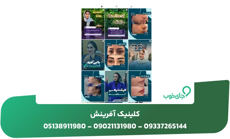 قبل و بعد برخی از خدمات کلینیک زیبایی آفرینش