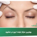 بهترین مرکز لیفت ابرو در مشهد