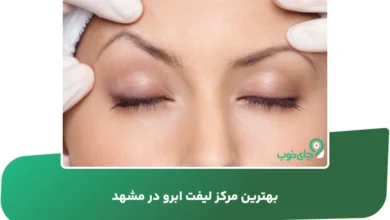بهترین مرکز لیفت ابرو در مشهد