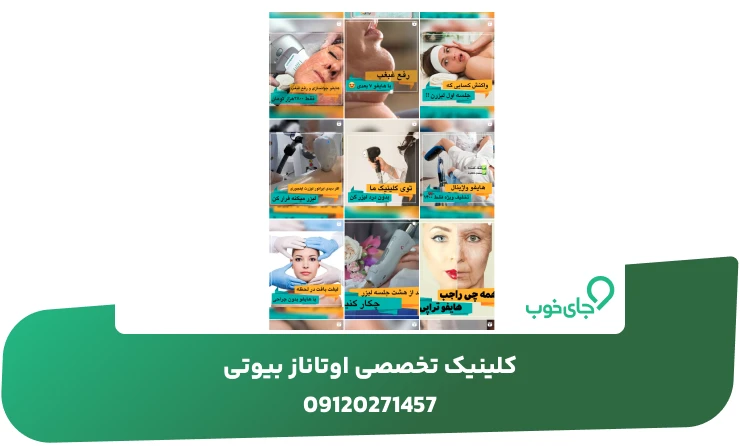نمونه کار کلینیک تخصصی اوتاناز بیوتی