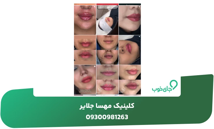 نمونه کار کلینیک مهسا جلایر