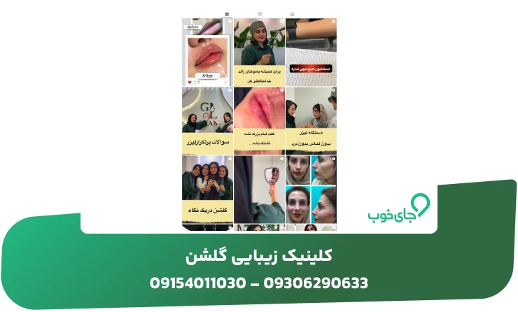 نمونه کار کلینیک زیبایی گلشن